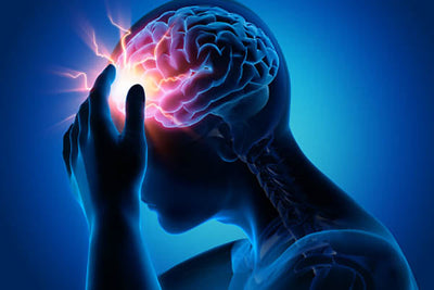 Migraines